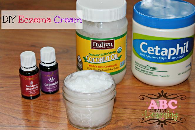 DIY Homemade Eczema Cream with Essential Oils - Simply Today Life