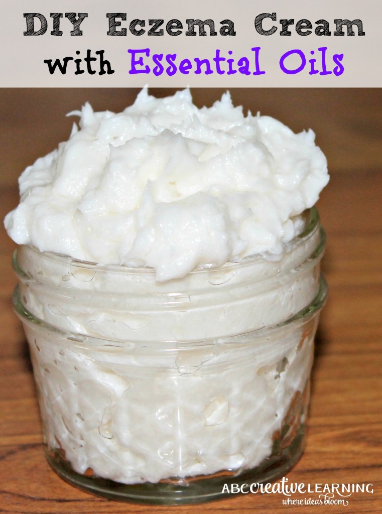 DIY Homemade Eczema Cream with Essential Oils - Simply Today Life