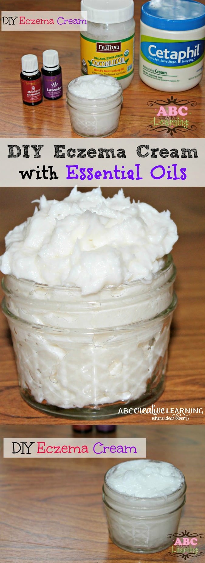 DIY Homemade Eczema Cream with Essential Oils - abccreativelearning.com